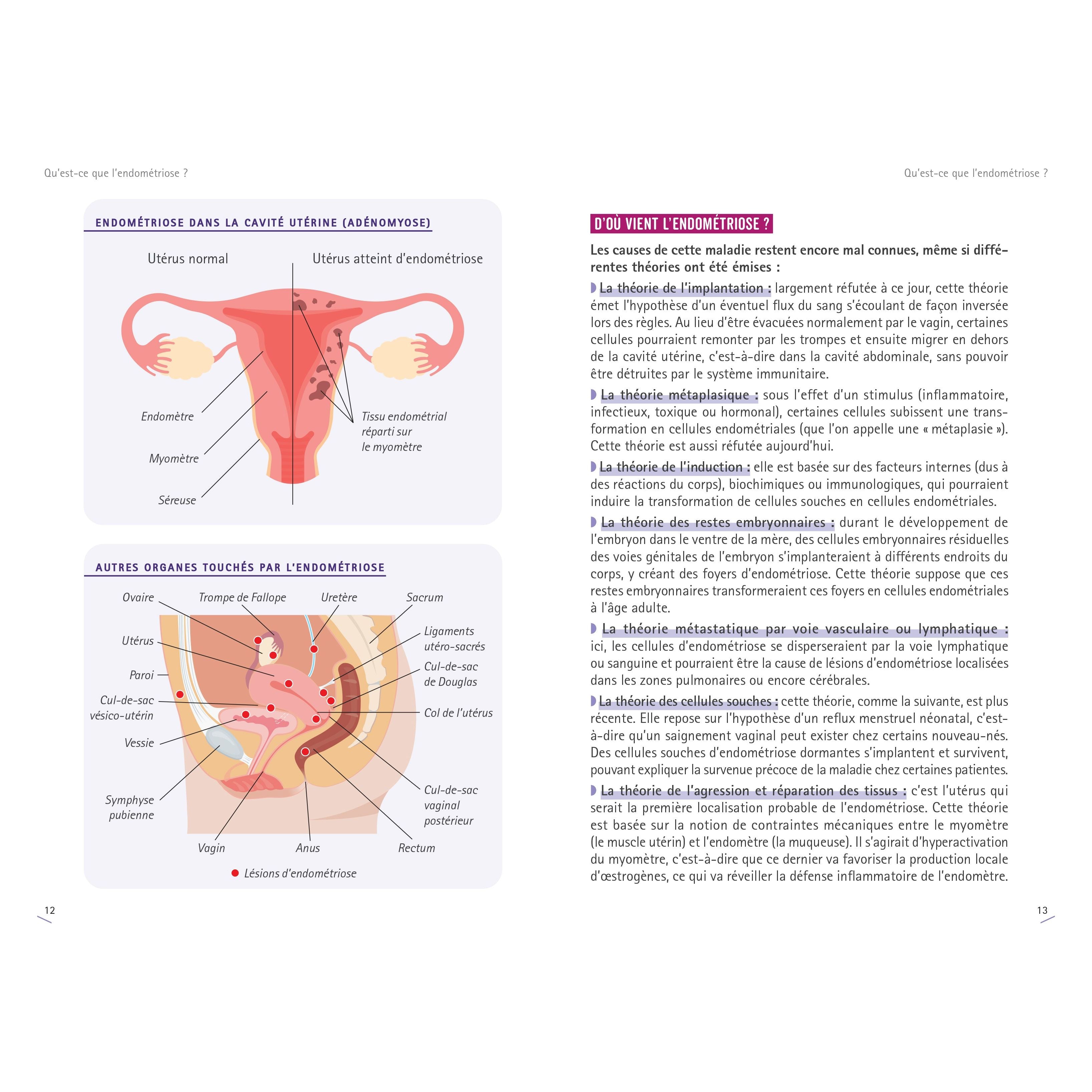 Soulager l'endométriose grâce à une alimentation anti-inflammatoire ! - Larousse Ed. - Livre de cuisine - - La Guilde Culinaire